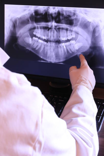 Best Tooth Infection Emergency Dentist  in Bourbon, MO