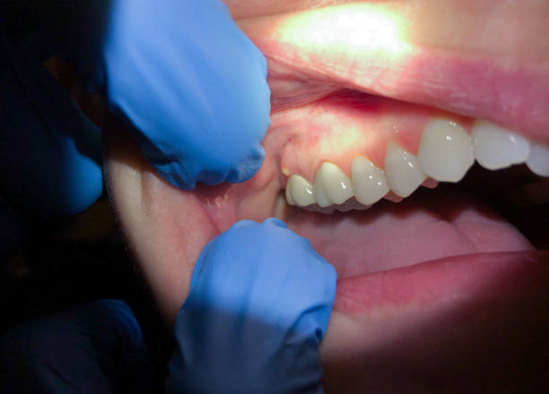 Dentist for Dental Trauma in MO